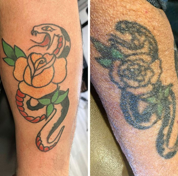 father has had this snake on his arm