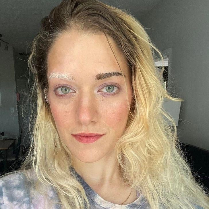 her foreheads white