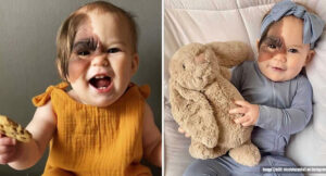 A Mother Posted an Unusual Birthmark of Her Daughter